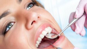 Подробнее о статье О методах реставрации зубов