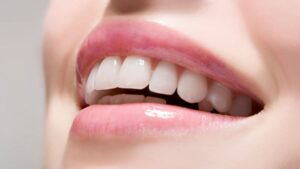 Подробнее о статье Удаление зубного налёта air-flow – мифы или реальность?
