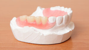 Подробнее о статье Как изготавливают акриловые зубные протезы