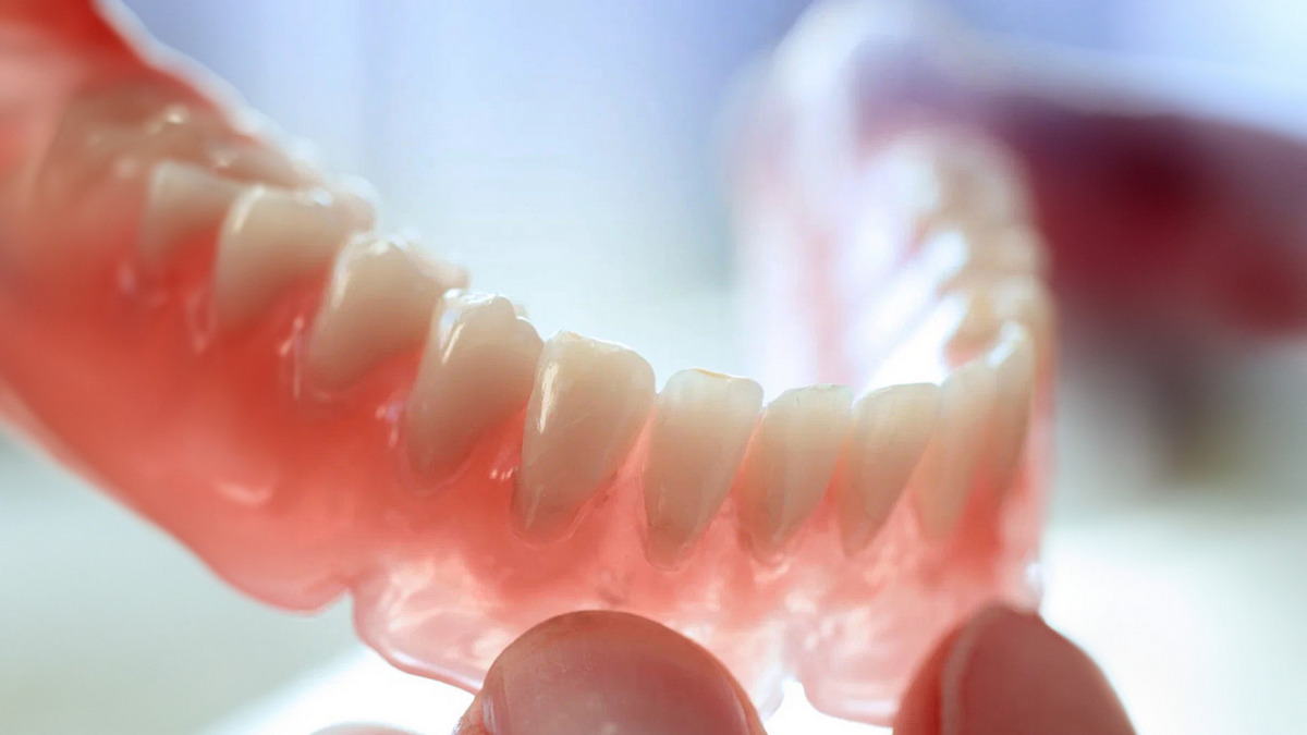 Вы сейчас просматриваете Нейлоновые зубные протезы – преимущества и недостатки