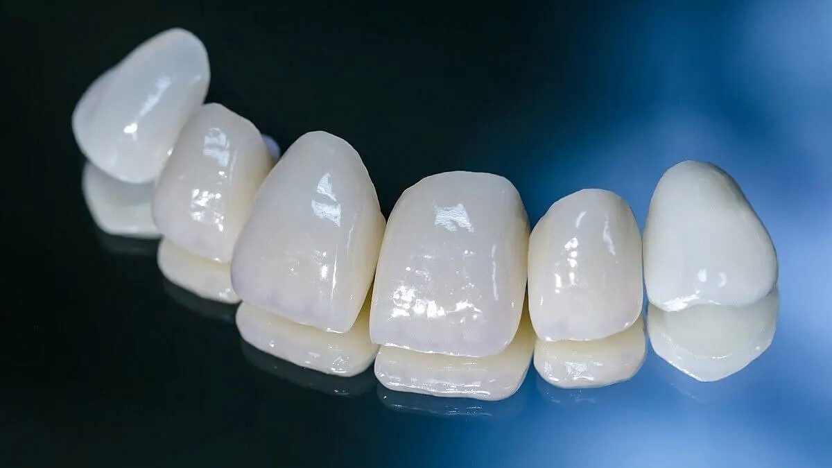 Подробнее о статье Преимущества циркониевых зубных коронок