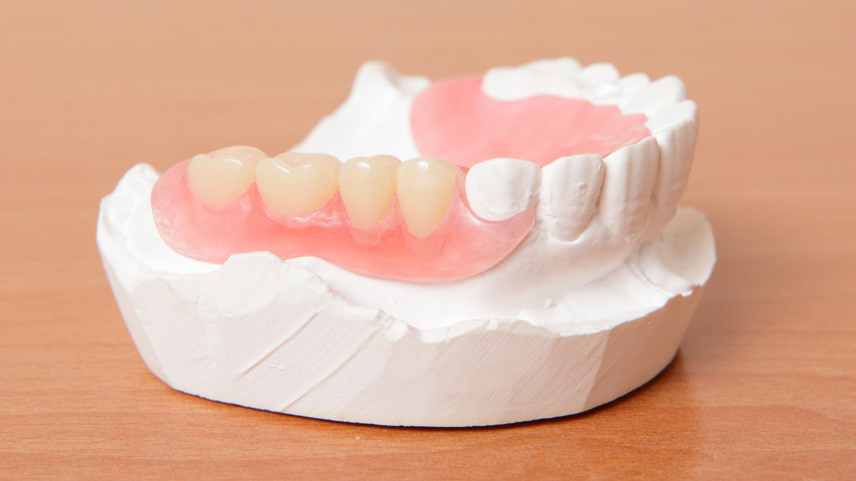 Вы сейчас просматриваете О протезировании после удаления зуба
