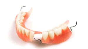 Подробнее о статье Правила пользования съёмными зубными протезами