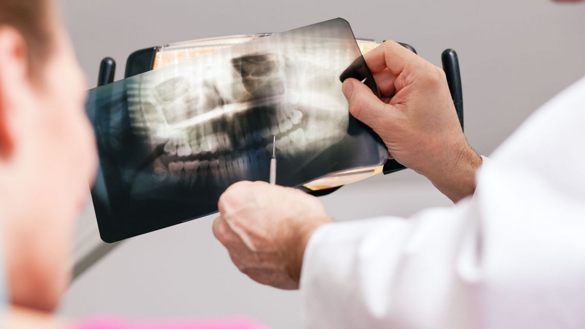 Подробнее о статье Снимок зубов – выбираем метод рентген-диагностики